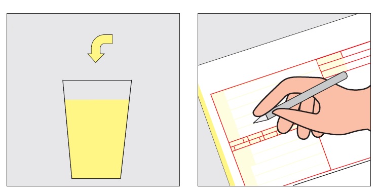 Priprema za biohemijsku analizu uzorka urina i 24h urina 1 Uputstvo za analizu uzorka urina