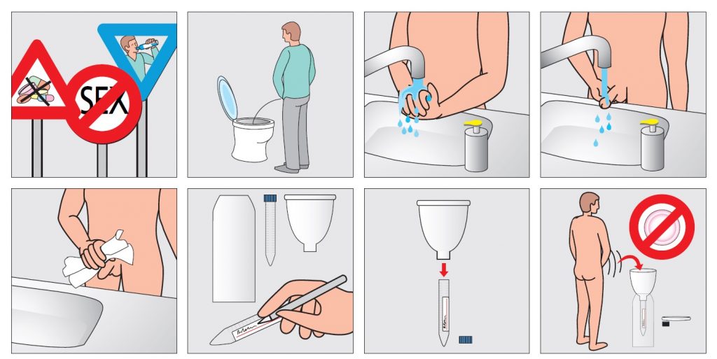 Priprema pacijenata za analizu spermograma 1 Uputstvo za uzimanje uzorka sperme za određivanje spermograma