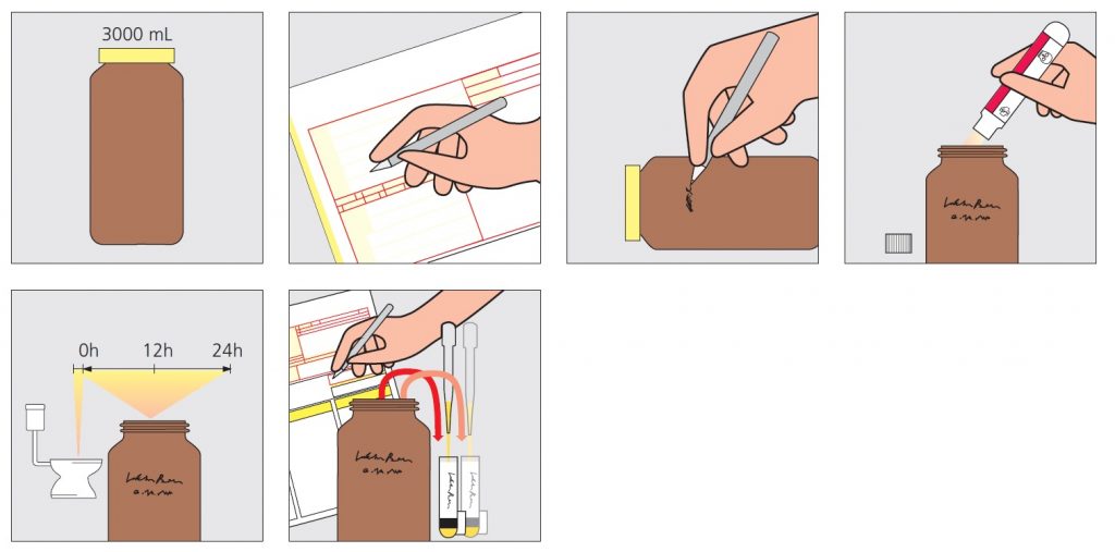 Priprema za biohemijsku analizu uzorka urina i 24h urina 2 Priprema za biohemijsku analizu uzorka urina i 24h urina 1
