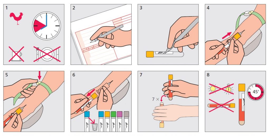 Priprema pacijenta za davanje uzorka krvi 1 Priprema pacijenta za uzimanje uzorka krvi