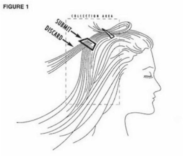 Priprema pacijenta za uzorkovanje za mineralnu analizu kose 2 Priprema pacijenta za uzorkovanje za mineralnu analizu kose