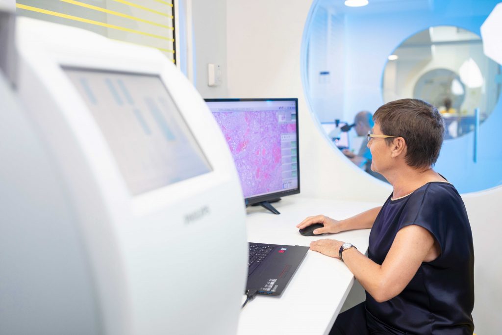 Rak debelog creva 4 Rak debelog creva 1