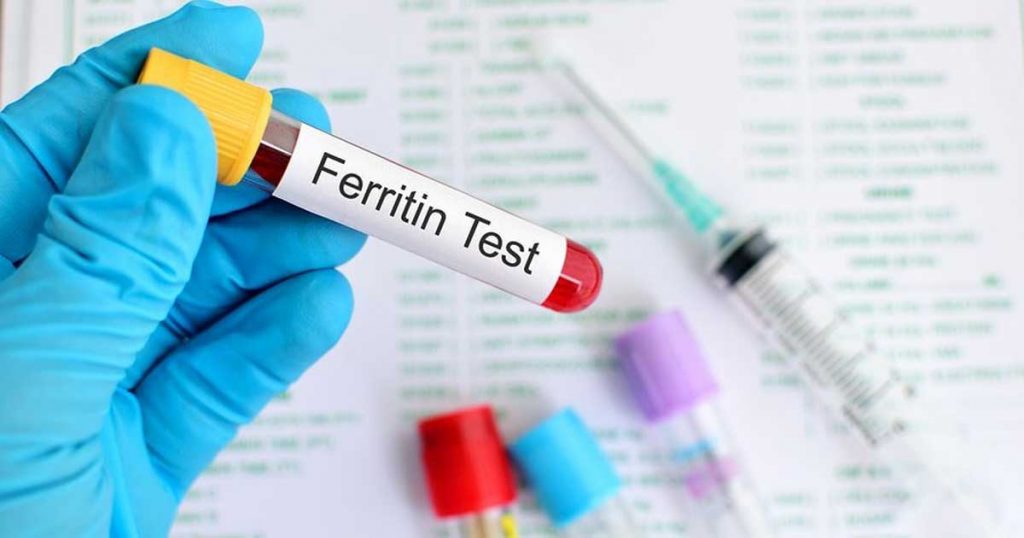 feritin analiza 