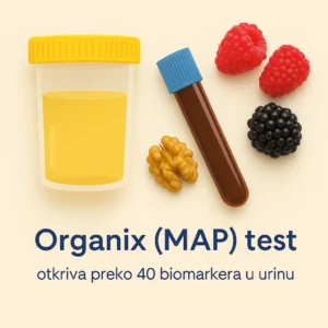 Značaj funkcionalne medicine kod poremećaja autističnog spektra 4 Organix test (MAP test)