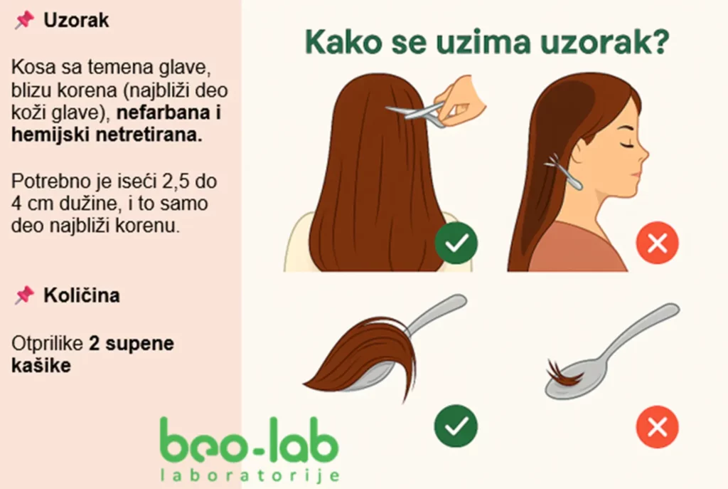 Mineralna analiza kose 1 Mineralna analiza kose 1