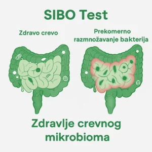 SIBO - prekomerno razmnožavanje bakterija u tankom crevu 2 SIBO test (Sindrom kontaminiranog creva izdisajni test)
