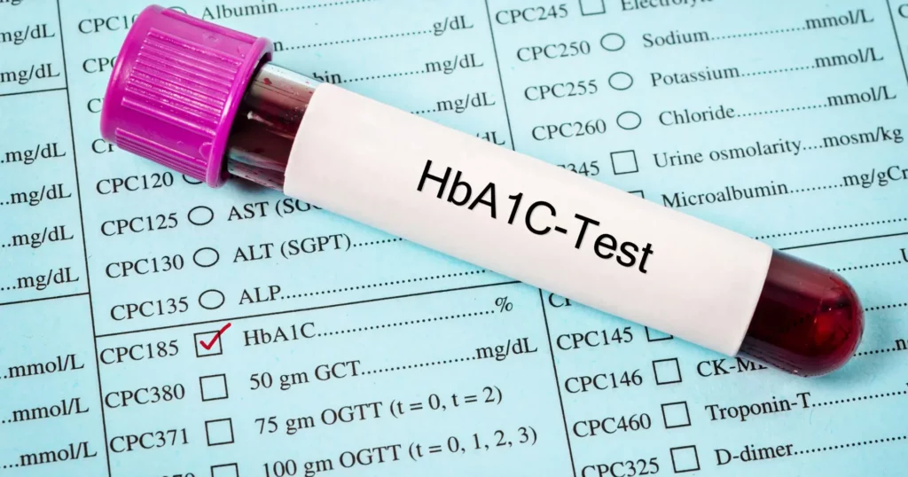 HbA1c - procena prosečnog nivoa šećera u krvi u dijagnostici ili kontroli dijabetesa 1 HBA1C test