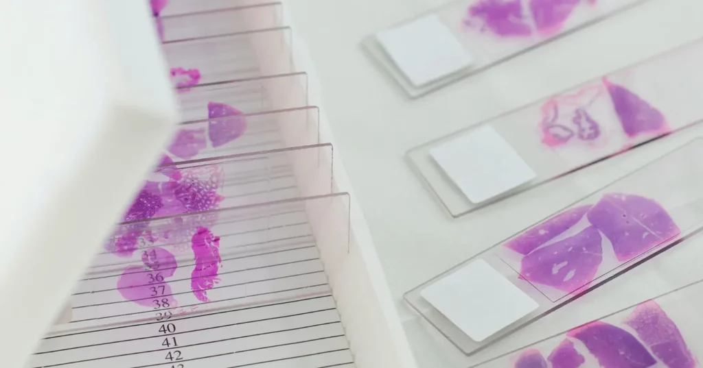 Patologija - put do precizne dijagnoze 1 Beo-lab-laboratorija-za-patohistologiju