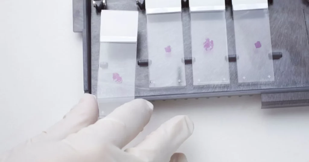 Patologija - put do precizne dijagnoze 3 Koje su sve analize dostupne u Beo-lab laboratoriji za patohistologiju