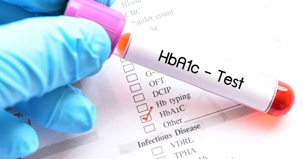HbA1c - procena prosečnog nivoa šećera u krvi u dijagnostici ili kontroli dijabetesa 2 HBA1C referentne vrednosti