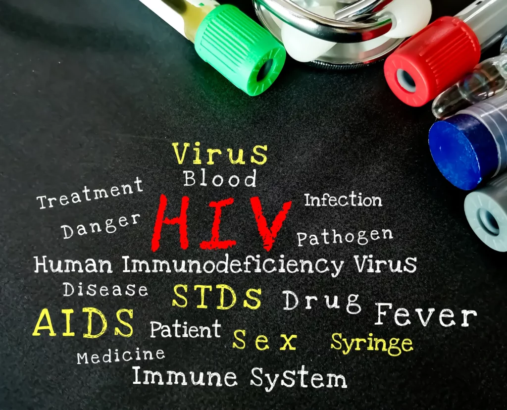 HIV/AIDS – uzroci, simptomi, dijagnoza 5 HIV/AIDS – uzroci, simptomi, dijagnoza 1