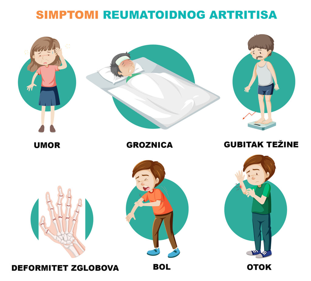 Reumatoidni artritis – simptomi, uzroci, dijagnostika i terapija 3 Reumatoidni artritis – simptomi, uzroci, dijagnostika i terapija 2