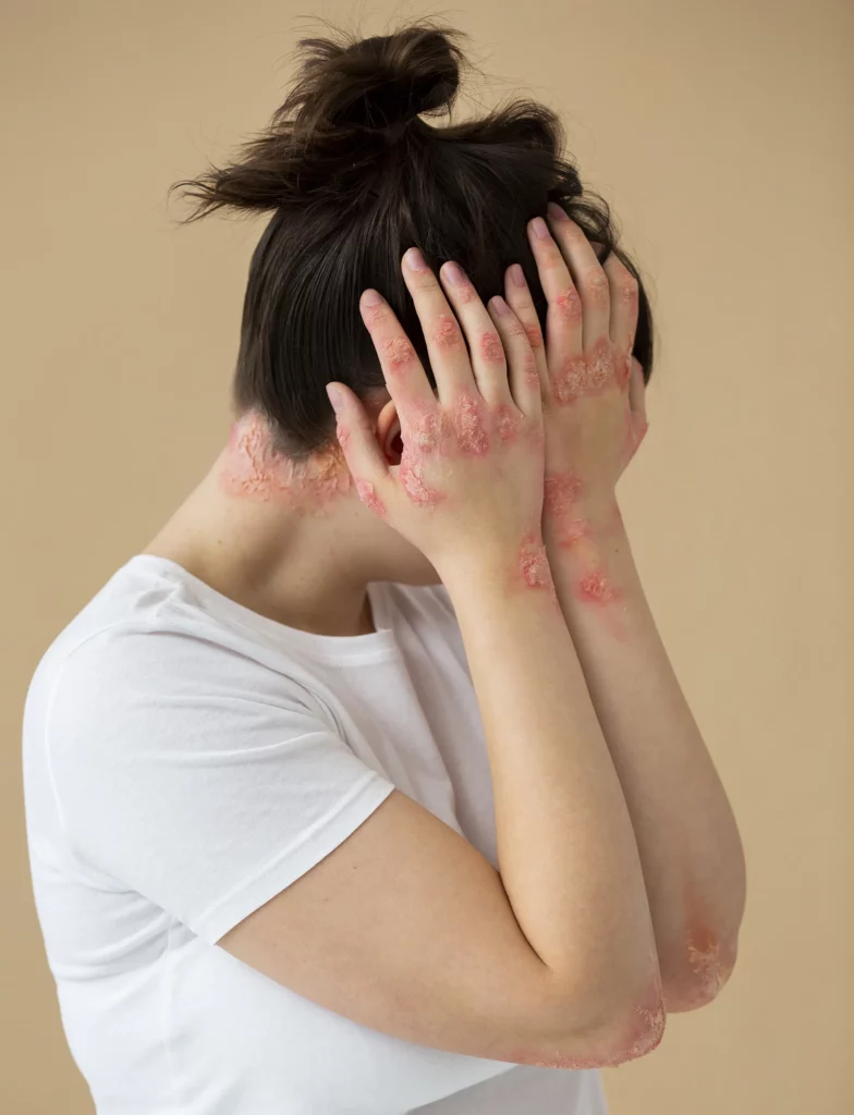 Juvenilni (dečiji) reumatoidni artritis – tipovi, simptomi, dijagnostika i terapija 2 Juvenilni (dečiji) reumatoidni artritis – tipovi, simptomi, dijagnostika i terapija 2