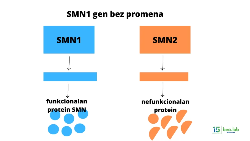 Spinalna mišićna atrofija-simptomi, uzrok nastanka, postavljanje dijagnoze i lečenje 5 Spinalna mišićna atrofija-simptomi, uzrok nastanka, postavljanje dijagnoze i lečenje 5