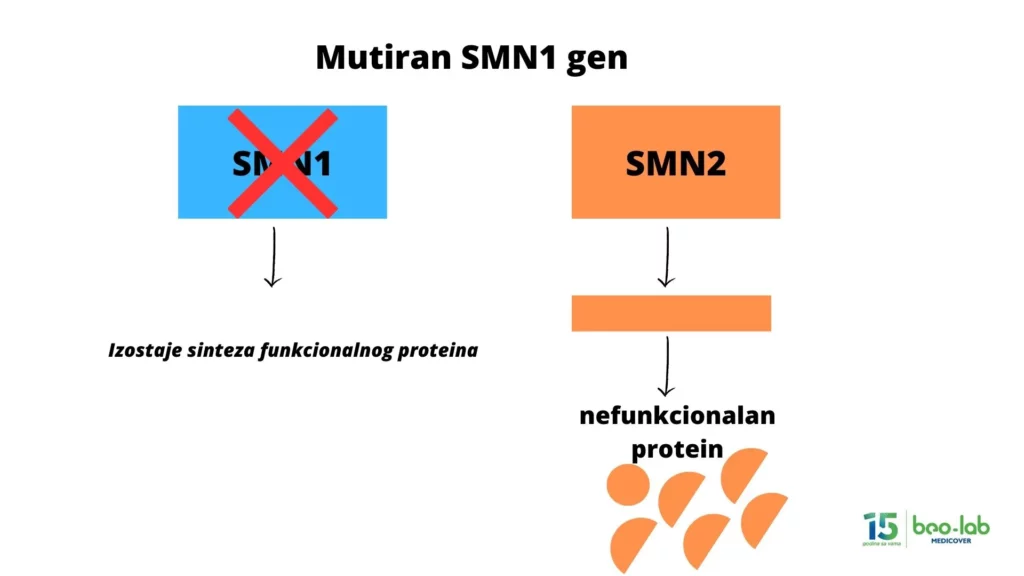 Spinalna mišićna atrofija-simptomi, uzrok nastanka, postavljanje dijagnoze i lečenje 6 Spinalna mišićna atrofija-simptomi, uzrok nastanka, postavljanje dijagnoze i lečenje 6