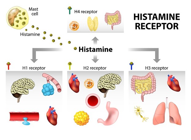 Intolerancija na histamin 1 Intolerancija na histamin 1