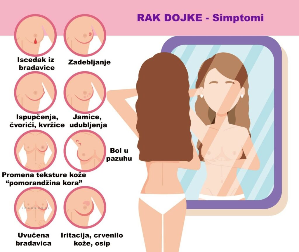 Rak dojke – šta bi svaka žena trebalo da zna? 2 Rak dojke – šta bi svaka žena trebalo da zna? 2